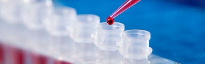 PCR 检测