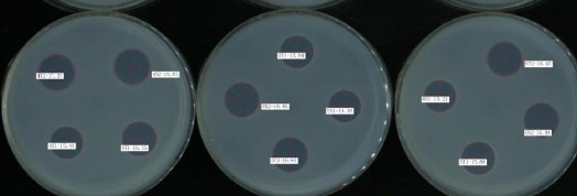 抗生素微生物检测