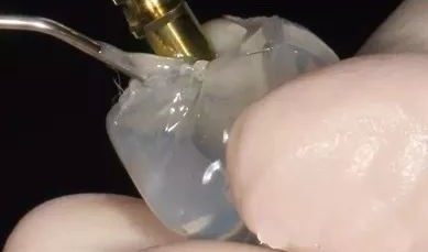 牙齿铸造包埋材料检测